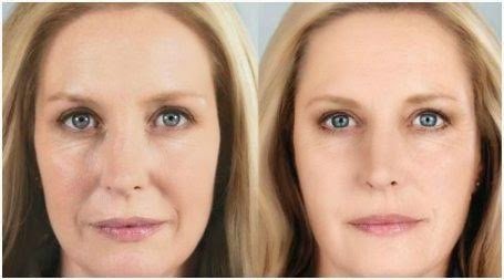 AF1QipMLdf4EdM4--1WbUGUNq8dUvEpS5yVQnC3icCl4=w800-h500-k-no