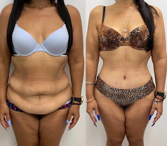 Oppenheimer Plastic Surgery