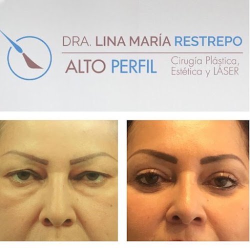 Alto Perfil Cirugía Estética Alto Perfil Cirugía Estética