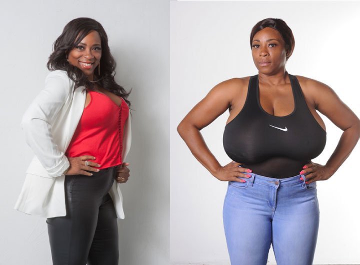 precio-reduccion-senos precio reduccion senos